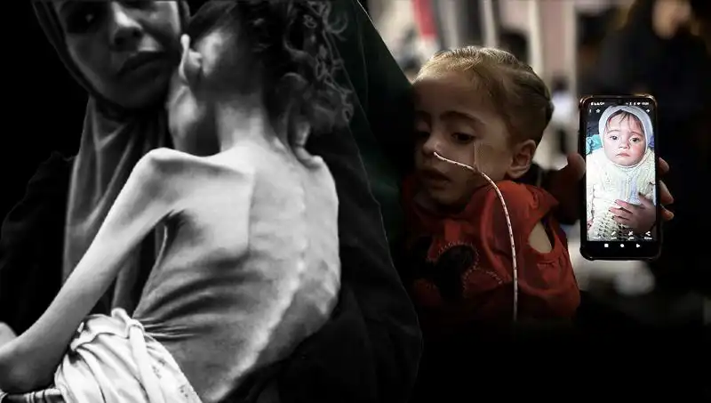 Meryem’in Acı Hikayesi: 25 Kilodan 10 Kiloya Düşüş İle Açlıkla Mücadelesi
